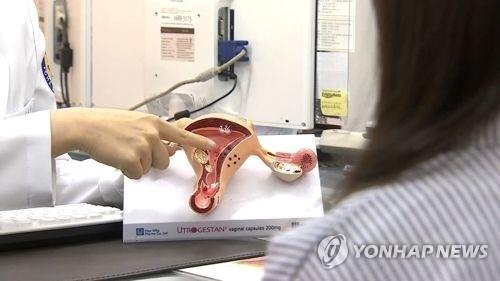 인공 체외수정 모습을 설명하는 장면. 연합뉴스