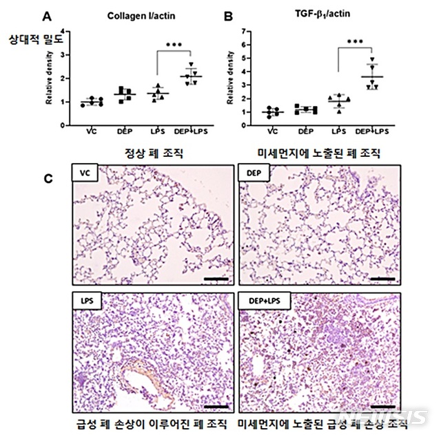 [대전=뉴시스] 실험대조군별 TGF-β1과 Collagen I 발현 및 폐내 TGF-β1의 조직면역염색.