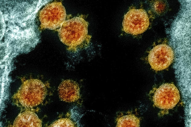 미국 국립알레르기·전염병연구소(NIAID)에서 제공한 신종 코로나바이러스의 전자현미경 이미지.
