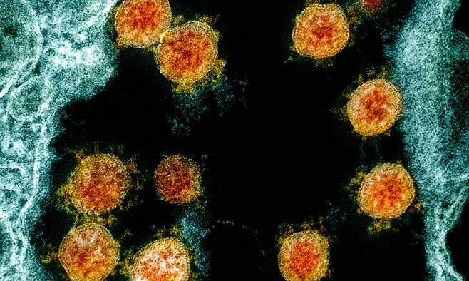 인체에 감염된 코로나 바이러스(주황색)의 전자현미경 사진. 최근 영국에서 돌기(스파이크) 단백질이 달라지면서 전염력이 세진 변이 바이러스가 급증해 새로운 대유행의 전조라는 우려가 나온다. /NIAID