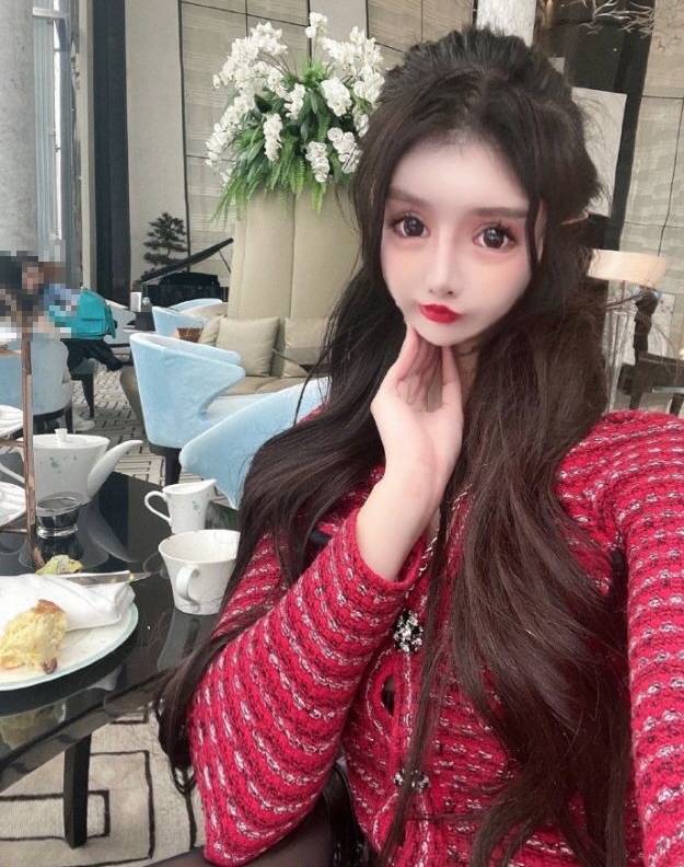 성형 후 현재 모습.