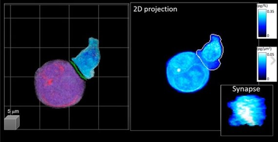 한국과학기술원 연구진이 3차원 세포 분석 기술을 이용해 암세포(보라색)와 면역항암 CAR-T세포(파란색)간 상호작용이 일어나는 순간을 포착했다. KAIST 제공