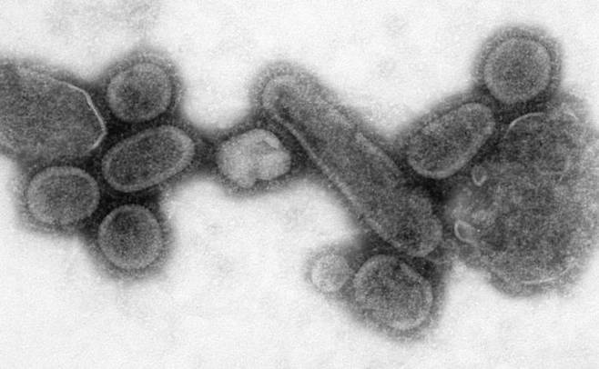 '스페인 독감' 바이러스 (H1N1 인플루엔자 A 바이러스) ▲ Photo Credit: Cynthia Goldsmith Content Providers(s): CDC/ Dr. Terrence Tumpey