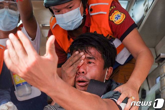 20일(현지시간) 미얀마 만달레이에서 군사 쿠데타를 규탄하는 시위대가 경찰의 고무탄에 맞아 부상당한 눈을 의료진의 치료를 받고 있다. © AFP=뉴스1 © News1 우동명 기자