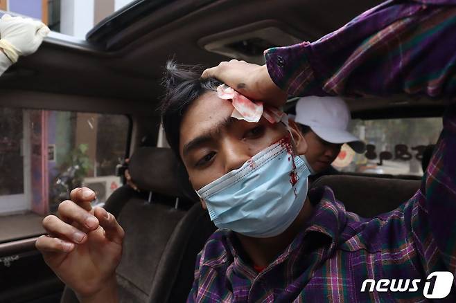 미얀마 제2도시 만달레이에서 2021년 2월 20일 군부 쿠데타 항의 시위에 참가한 한 남성이 군·경의 강경 진압으로 머리에 부상을 입고 피 플리는 모습. © AFP=뉴스1 © News1 최서윤 기자