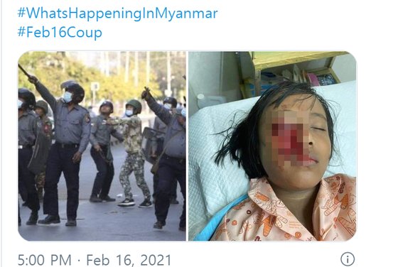 만달레이에 거주하는 9살 미얀마 소녀가 지난 15~16일 군경의 고무탄총, 새총 무차별 발포 당시 한쪽 눈에 새총을 맞고 실명했다는 소식이 SNS를 통해 퍼졌다. [트위터 갈무리]