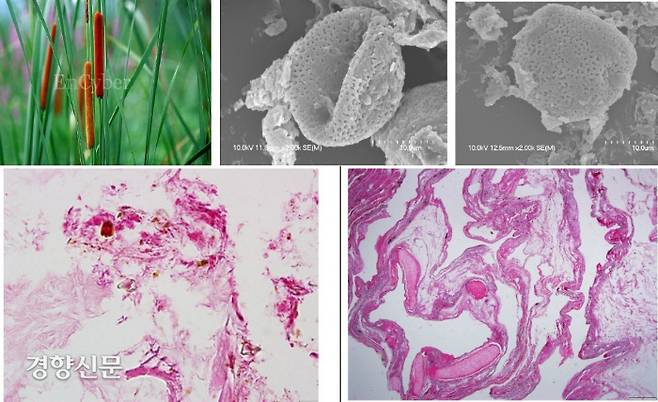 위 사진은 애기부들(출처: 네이버)과 학봉장군 장기에서 발견된 부들 화분의 주사전자현미경. 아래사진은 ‘김의정 미라’의 소화기관에서 관찰된 애기부들 꽃가루(밑 왼쪽)와 왼쪽 폐에서 보이는 간흡충(밑 오른쪽). |정광호의 논문에서·김한겸 교수 제공