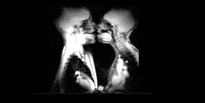 MRI 스캐너로 촬영한 남녀의 키스 장면. 유투브 갈무리