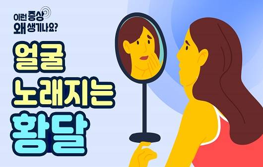 얼굴 노래지는 황달