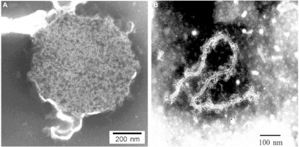 출처: Hendra and Nipah viruses: pathogenesis, animal modes and recent breakthroughs in vaccination
