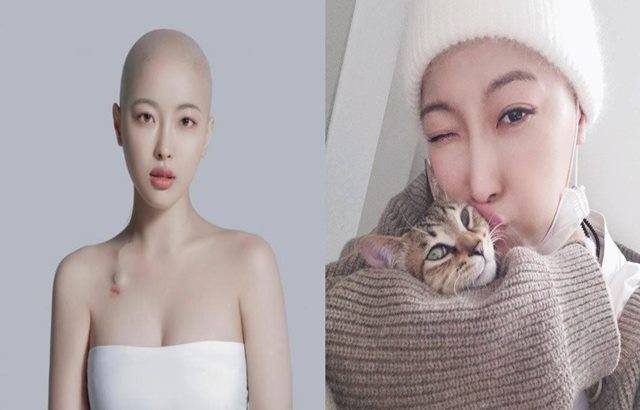 뷰티 유튜버 새벽(본명 이정주)이 혈액암 투병 끝에 사망했다. 향년 30세. /새벽 인스타그램 캡처