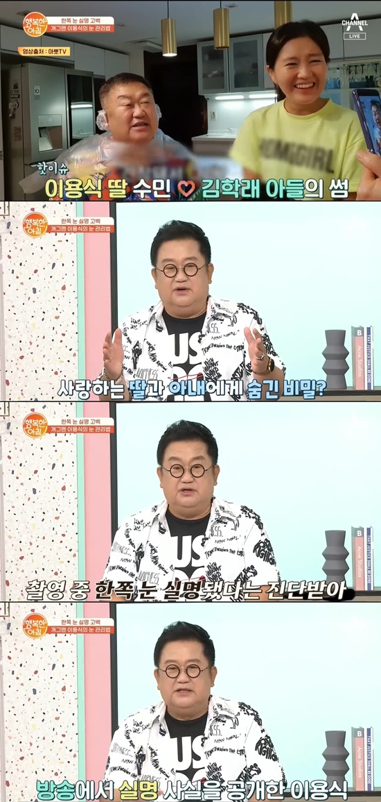On Channel A Happy Morning broadcasted on the 27th, guest Yong-Shik Lee appeared and talked about eye health.Yong-Shik Lee, who appeared in the studio on the day of mass production, said, I believe and find comedian Poshik is Yong-Shik Lee. He said, I came out with mass production for eye health.Lee Jae-yong said, Usually, if you use mass production, your body will be covered, but Yong-Shik Lee will only cover your face. Then Yong-Shik Lee said, You only have to cover your face.I gave up my body, he said, laughing.Yong-Shik Lee said, It was the first public bond in the history of Korean broadcasting. It was selected in 75 years. It is now 46 years.So MCs asked the secret of playing a big role even now.Yong-Shik Lee said, I always think about what many people like and I do not have to stop constantly. I have a lot of time at home these days, so I am doing personal broadcasting with my daughter SUMIN.Gag Woman Kim Hye-sun said, I met a lot with SUMIN, and I also boast about my dad.Recently, there is a story about Kim Dong-young and Thumb Tanda, said Yong-Shik Lee, who mentioned the thumb of her daughter SUMIN.It is past the age of meddling in the way that they do it alone, he said. Even if you are married, or not, you are not.I do not intend to send a marriage, or I will live up and down because there is a double layer, he said.On the other hand, Yong-Shik Lee attracted attention by saying that he had hidden secrets from his beloved daughter and wife.Yong-Shik Lee said: In fact, in my case, one eye hurt as I filmed the broadcast. It became a blindness.I did not want to hurt the family, so I kept it a secret. There was a moment when I was on a health pro and talking about eye health and testing it.I thought I should hide or inform myself, he said. No, I think that there should be no one like me who misses Golden Time. I made it public so that I could prevent it quickly because of me. I did not tell the Family the date of broadcasting, but the next day I saw the Family on the Internet, he said.Family says, Im going to be one sick eye. Thats Family. She expressed her affection for Family.In addition, Yong-Shik Lee said, We treat (ophthalmology) once every two or three months in the hospital and check what the condition is like than last time to protect eye health.Yong-Shik Lee, who lost his eyesight due to retinal vascular closure, said, I think I overworked in the process of preparing for a small theater. I was nervous and looked at things one day, and it looked normal and bent.He said, If I rest for two days, the symptoms will disappear.The most important thing is that I missed Golden Time, he said, regretting the moment when he was not diagnosed by a specialist.An ophthalmologist who met Yong-Shik Lee said, My nerves are all dead.The nerves are all dead, crushed and distorted, and eventually they can not function. The right eye said that the optic nerve damage and macular degeneration have progressed.The left eye is keeping the nerves clean and well, Yong-Shik Lee said, asking if there is anything to be careful about for summer eye health.Urbans are strong in summer; its good to wear sunglasses; you should avoid excessive drinking, and avoid fatty foods, the specialist advised.Photo: Channel A broadcast screen