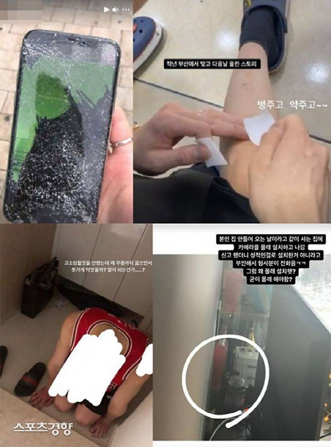 A씨는 정지석으로부터 당한 데이트 폭력 주장과 함께 피해 사진을 일부 공개했다. 인스타그램 스토리 캡처