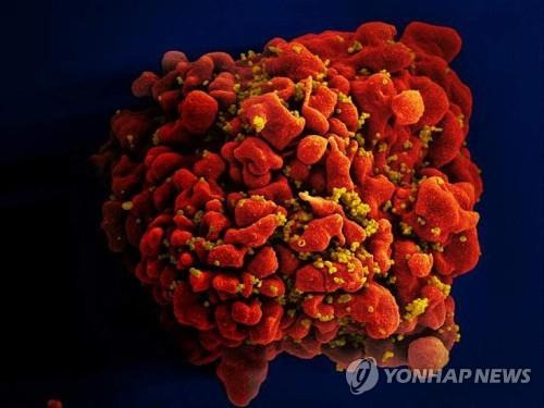 HIV 바이러스에 감염된 인간 백혈구 세포 모습 [미국 국립보건원·NIH 제공 AFP=연합뉴스 자료사진]