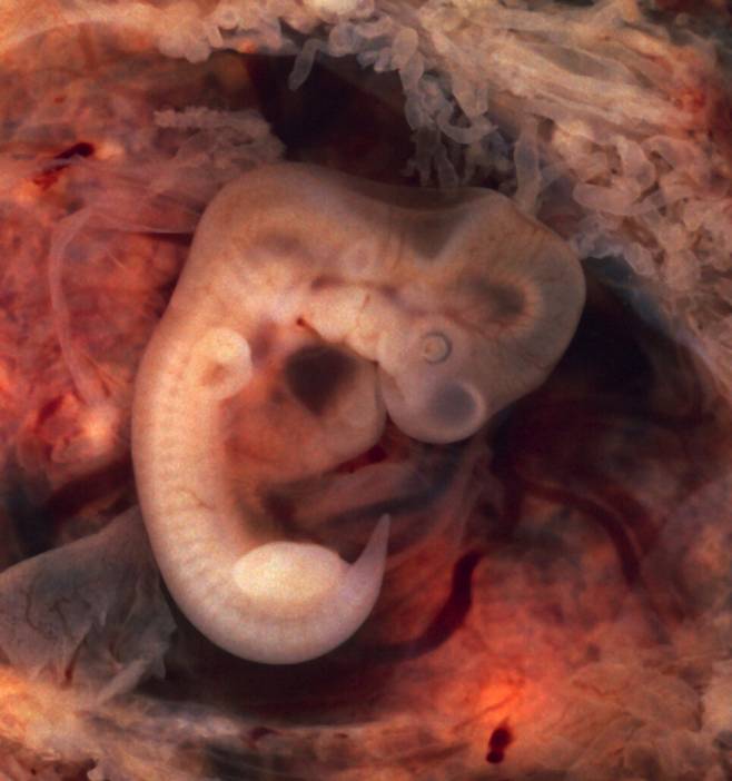 사람은 꼬리가 없지만 태아는 4주 동안 꼬리가 발달하다 사라진다. 임신 7주째 태아의 모습. 위키미디어 코먼스 제공.
