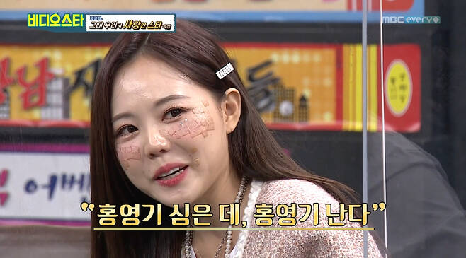 MBC Everlons Video Star (hereinafter referred to as Video Star), which was broadcast on the 28th, featured the pronoun Hong Yeong-gi of Earl Chan, which told the recent situation.On this day, Hong Yeong-gi said, It is called Hong Yeong-gi, who started from Eulchan and is now a mother.Hong Yeong-gi, who is 140cm tall, boasted of his artistic sense, saying he wanted to compete with Park Na-rae; the result was a very narrow victory for Hong Yeong-gi.Park Na-rae asked, Whats that on Mr. Young-gis face, is it trendy these days? Because Hong Yeong-gi was taped to his face.Hong Yeong-gi said: I had a laser procedure; I wanted to look pretty after hearing the news of my appearance on Video Star, so I had a frugi.I didnt know it was sticking this long (because I couldnt recover), he explained.Hong Yeong-gi, who was famous for his talent, said, There was no contest, no audition, who posted my mini-homepage address as a styled general person.I lived with Grandmas Boy and styled with Grandmas Boy clothes, and after that, pictures were uploaded to the famous community.He said he was a good boy. Hong Yeong-gi also said, In the past, there were so many people that people were paralyzed in any area.It was like an entertainer guerrilla concert, he said. I remember a hand letter from a prison. I have said that the person who is in prison is getting hope when he sees me.Hong Yeong-gi said she was a child-rearing mother with two sons and said: I gave birth to two children.The first is the second grader at Elementary School and the two are seven years old. About the first meeting with Husband, who is three years younger, Husband and I have taken a uniform model.I went to the movie early and Husband said, Ill only see the movie with you in the future. Later, I confessed. When asked about the goodness of Husband, Hong Yeong-gi laughed, saying, The good thing these days is that the skin is resilient, it is three years old and it is different.I have a lot of hair. I look pretty to that part. I feel like this is what it is, he said.Hong Yeong-gi also commented on his first son, I have a really similar personality than my face: I loved money when I was a child, and there is a fantasy about Sams Club, playing culture.Elementary school, sophomore, but he said, Im going to be richer than Lee Jae-yong.Also in the car, I ask you to play Sams Club song. Photo: MBC Everly One broadcast screen