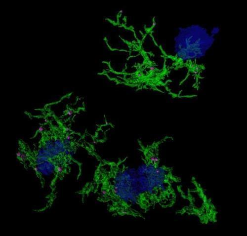 뇌에서 아밀로이드 플라크(청색)를 삼키는 소교세포(녹색) [싱가포르 Duke-NUS Medical School / 재판매 및 DB 금지]