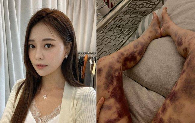 ⓒ아옳이 인스타그램