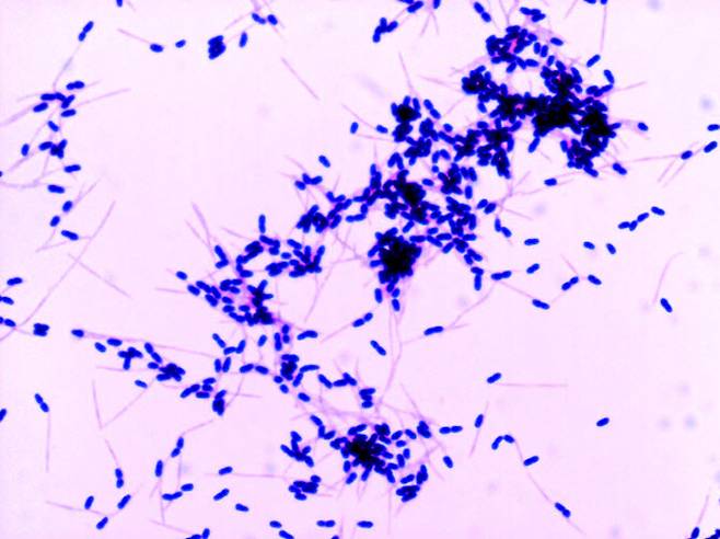oraCMU가 유해균 Fn균을 억제하는 모습