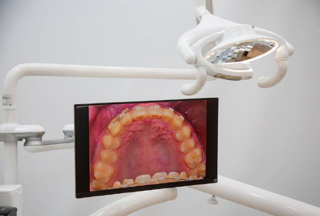 치석은 특히 아랫니 앞니 안쪽에 잘 생긴다. 치석이 생기는 걸 방지하고 싶다면 이 부위를 평소 세심하게 관리해줘야 한다./사진=클립아트코리아