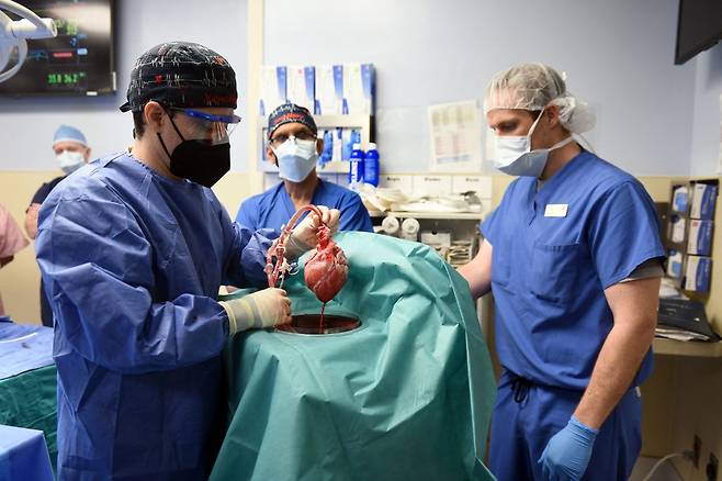 미국 메릴랜드대 의대 연구진이 환자에게 이식할 돼지 심장을 들어보이고 있다./사진=AFP