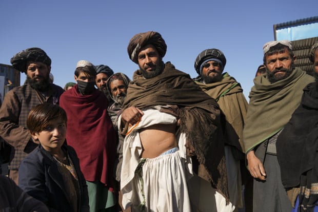 불법 장기 매매 과정에서 남은 수술 흉터를 보여주는 아프간 남성