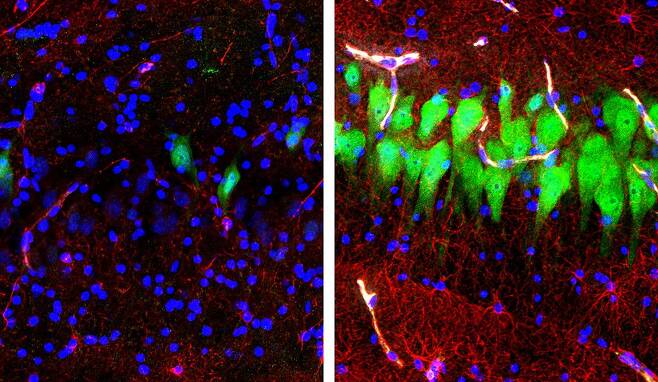 돼지가 죽은 지 10시간 지나 그대로 방치한 뇌(왼쪽)와 인공혈액을 주입해 재생시킨 뇌(오른쪽). 뇌 기억중추인 해마에서 신경세포(녹색)와 이를 보호하는 성상세포(붉은색), 세포핵(파란색)이 크게 달라졌다./미 예일대