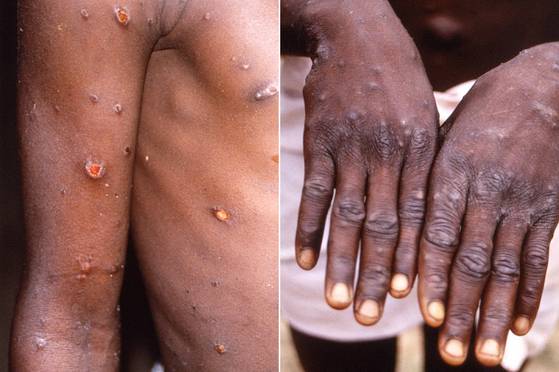 〈사진=로이터/연합뉴스〉