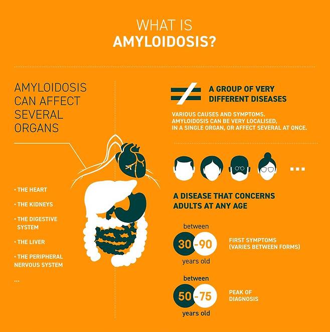 아밀로이드신경병증 참고 이미지