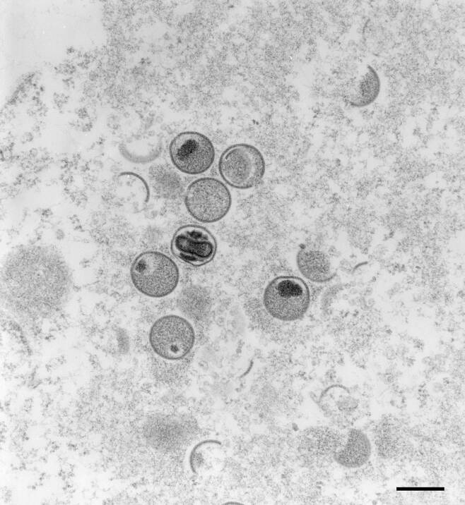 원숭이 두창 바이러스를 독일 로베르트 코흐 연구소(RKI)가 2004년 전자현미경으로 촬영한 사진. /연합뉴스