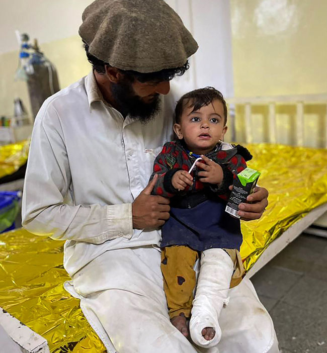 22일(현지시간) 아프가니스탄 남동부 파크티카주에서 발생한 강진으로 약 1000명의 사망자가 발생한 것으로 알려진 가운데 지진으로 부상을 입은 아동이 현지 병원에서 치료를 받고 있다. 연합뉴스·AFP