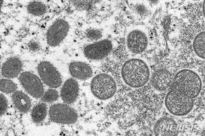 [AP/뉴시스]미국 질병통제예방센터가 공개한 원숭이두창 바이러스. 2022.06.23.