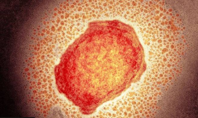 원숭이두창을 일으키는 ‘몽키폭스’(monkeypox) 바이러스 입자를 자세히 들여다본 모습. BBC 홈페이지 캡처