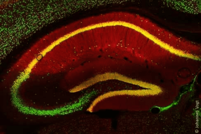 모델 쥐의 뇌 신경세포 (자료=요하네스 보그트)