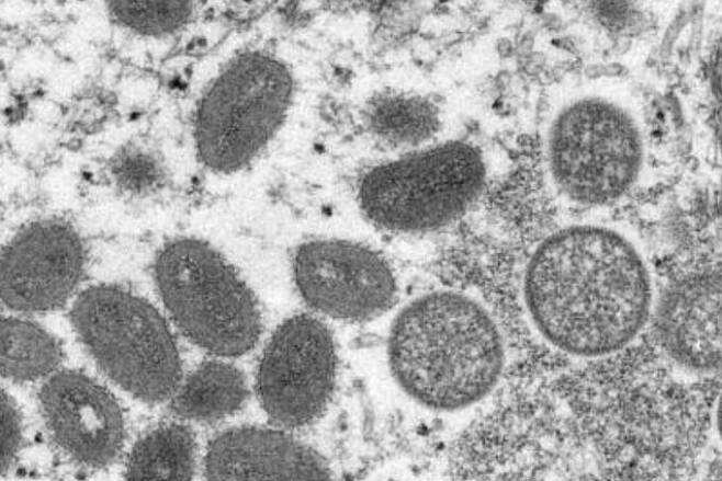 원숭이두창 바이러스의 입자 현미경 이미지
