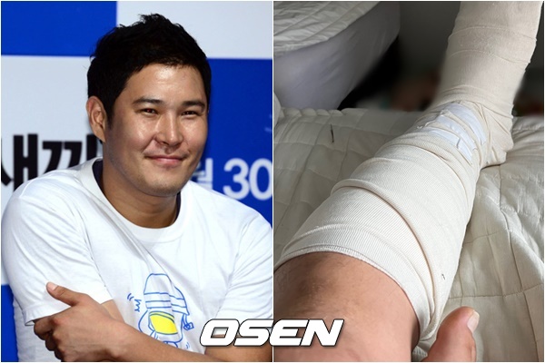Actor Jo Ji-Hwan is scheduled to operate after suffering a leg injury from a ruptured Achilles tendon.As a result of the morning coverage on the 1st, Gagwoman Jo Hye-ryuns brother and Actor Jo Ji-Hwan suffered a ruptured Achilles tendon while exercising last weekend and cast a leg in emergency action.Jo Ji-Hwan will soon be examined in detail at the hospital, and will undergo hospitalization and surgery procedures.Jo Ji-Hwan said, It is not a very serious injury, but it is a rupture of Achilles tendon, so I think surgery should be done. My wife is nursing next to me now.Jo Ji-Hwan has appeared with his wife Park Hye-min in MBC Oh Eun Young Report - Marriage Hell and collected a big topic, and he confessed real troubles and high-ranking conflicts between the couple.Recently, after the broadcast, the mother-in-laws heartfelt support for the show host activity of her daughter-in-law was conveyed, and she showed a warm-hearted appearance.Meanwhile, Jo Ji-Hwan plans to resume acting activities, including broadcasting, after recovering from Achilles tendon surgery.DB
