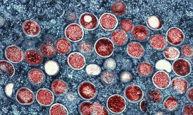 원숭이두창 바이러스 입자(붉은색) 전자현미경 이미지. AP연합뉴스