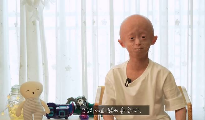 원기는 욘니라는 이름으로 영상을 만들고 많은 이들에게 용기를 주고 있다.