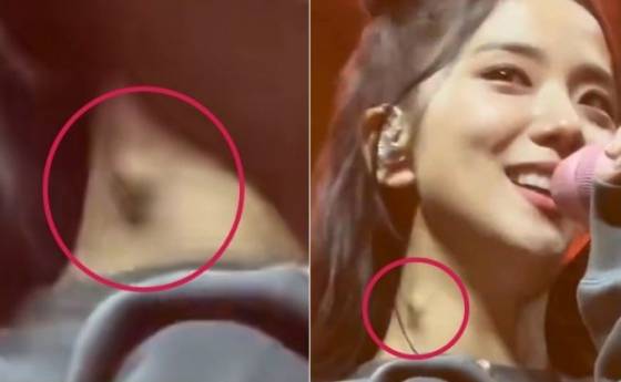 YG Entertainment, a subsidiary company, emphasized that there is no problem with the group BLACKPINK member Jisoos health problem.YG Entertainment said on the 4th, JiSoo is currently working on the World Tour schedule and there is no problem with health.In the photo, Jisoo, who is singing with a bright expression, was curious about the swelling of a small lump on his neck.This is not the first time a lump has been spotted on JiSoos neck. Earlier, there were fans who caught JiSoos lump during concerts and broadcasts, especially when the schedule was busy, and the possibility of diseases such as lymphoma was raised.Some of them also showed some issues surrounding BLACKPINKs World Tour performance.BLACKPINK currently has 14 tours in seven North American cities, including Dallas, Houston and Atlanta, since the release of their second full-length album, BORN PINK.JiSoos authenticity in relation to this photo remains a question, but the recent appearance of JiSoo in the official appearance did not seem to be a big problem.