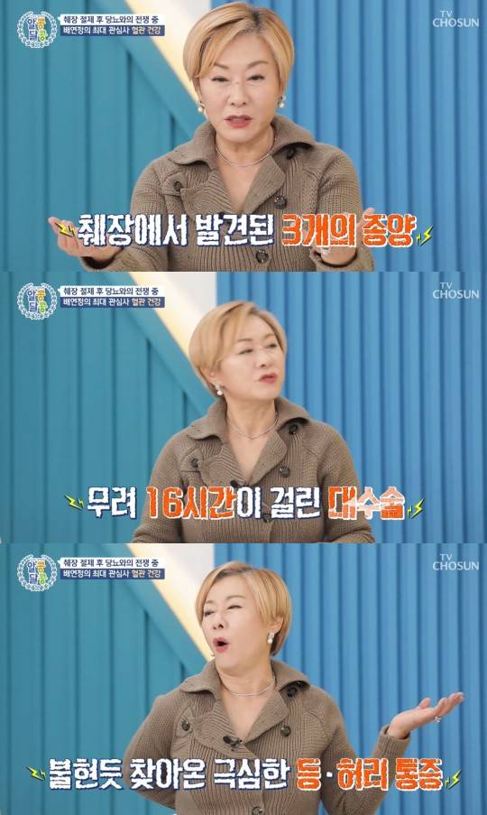 코미디언 배연정이 인생의 위기를 겪었던 당시를 떠올렸다. /사진=TV조선 '알콩달콩' 방송캡처