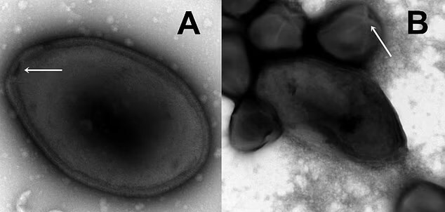 프랑스 엑스 마르세유 대학 연구팀이 4만 8000년이나 시베리아 영구동토층에 얼어붙어 있던 ‘판도라 바이러스 예도마’(Pandoravirus yedoma·이하 판도라 바이러스)를 부활시켰다