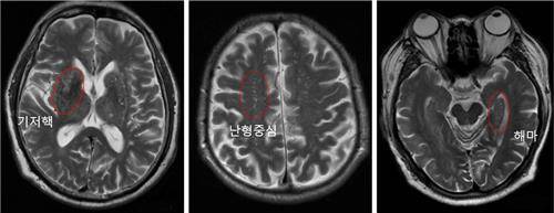 상계백병원 제공