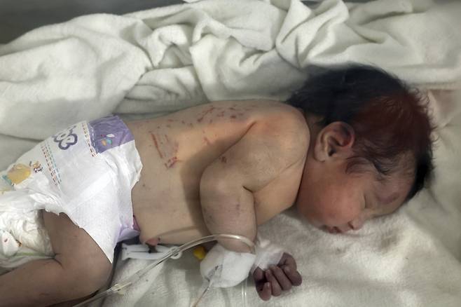시리아 강진 피해 현장에서 극적으로 구조된 신생 여아가 7일(현지시간) 알레포주(州) 아프린 어린이병원 인큐베이터에서 치료를 받고 있다. 아프린=AP연합뉴스