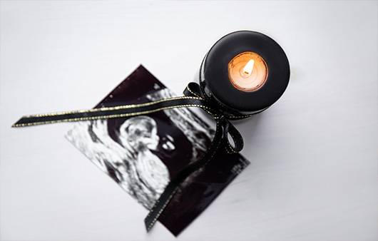 유산은 임신 20주 이전에 태아가 사망하는 것을 말한다ㅣ출처: 게티이미지뱅크