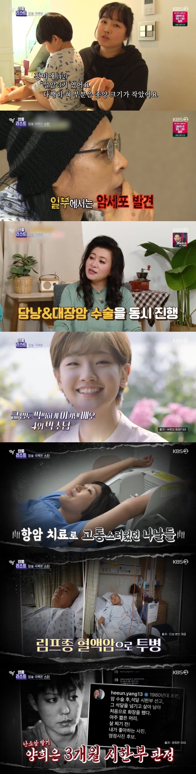 Stars who have overcome cancer have been introduced, from stars diagnosed with stomach cancer to stars who have been diagnosed with a three-month deadline.In the 123rd KBS 2TV entertainment year-round plus broadcast on March 9th, the ranking of stars who actively overcome cancer was revealed.Jung Mi-ae, who recently appeared on KBS 1TVs cultural program Human Theater, made headlines by revealing that she was diagnosed with the third stage of Seolam.Fortunately, the size of the tumor was smaller in the tongue, Jung said. At that time, I hated Husband humming next to me, she recalled.I asked him if he could sing, and he (the doctor) couldnt answer, she said after the surgery.Still, Jung Mi-ae, who overcame difficult things through her family, expressed her hopefulness, saying, I have the courage to be able to do it now.Kim Tae-won, the guitarist of the legendary rock band Resurrection, was diagnosed with dysplasia, a stage before cancer, during the filming of KBS 2TV entertainment Mans Qualification in 2011.In some cases, he was diagnosed with early gastric cancer as some cancer cells were found.Kim Tae-won recalled that the expression of the sky collapsing is not that. Above all, Kim Tae-won worried about his family.Kim Tae-won appeared on an entertainment show and said, Im not afraid of dying, but what about my beloved wife? What about my children? I was sorry to die.Fortunately, Kim Tae-won went into the operating room with the support of his wife and colleagues, and successfully completed the operation. Kim Tae-won returned to the air immediately after being healthy and impressed.In the fifth place, Dr. Oh Eun Young said, I had my first medical checkup in 2008, and I was diagnosed with a malignant tumor in my gallbladder during an ultrasound. In addition, cancer cells were found in my colon, so I had to undergo two surgeries together.Oh Eun Young said that the first person to come up at the time was his son. Son, my mother is sorry. I cried and cried and walked down the corridor.I can not see the growth of this child. I can not take the smell of this child, I can not touch this child with my hand. I could not bear it.Oh Eun Young later received a correct diagnosis that it was not gallbladder cancer. Colorectal cancer is relatively early and has recovered after treatment, and has been actively working as a certified childcare specialist to date.Actor Park So-dam, who was diagnosed with papillary cancer in 2021 when he was 29 years old and returned healthy six months after the outbreak, ranked fourth, followed by Jin-kyeong Hong, who was diagnosed with ovarian cancer and survived chemotherapy.Jin-kyeong Hong also used a wig because his head was exhausted during chemotherapy.Jin-kyeong Hong said in a broadcast, I do not know what chemotherapy felt like. I ate three bottles of shochu and got a hangover, and I had a cold. I ate rice cake there. But someone stepped on me on the way.The conclusion should not hurt, he said.Jin-kyeong Hong said, I downloaded the entertainment. I really laughed and laughed, and after seeing a few of them, the treatment was over for three hours. I was working philosophically in giving laughter.I am very proud that I am an entertainer. 