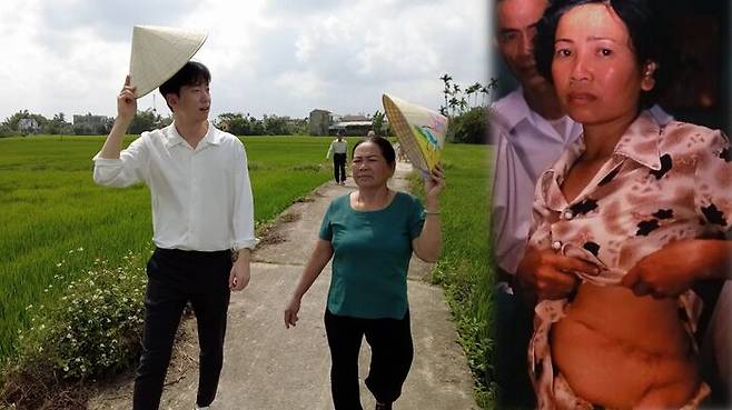 퐁니 사건 생존자 응우옌 티 탄 씨 (출처 : 고경태 기자)
