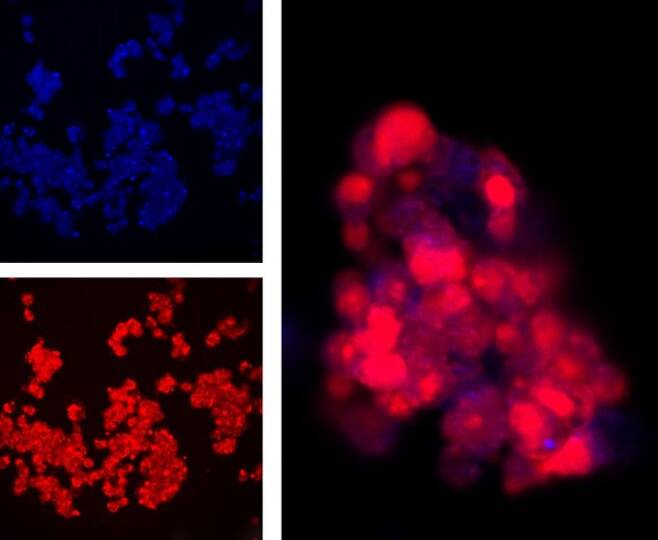표적 세포 시각화하는 탄소 양자점 - 탄소 양자점을 표적 세포에 붙인 뒤 빛을 쪼이면 가시광선을 방출하는 표적 세포를 시각화할 수 있다. 사진에서 붉은 색으로 드러난 부분들이 표적 세포다. 최근엔 탄소 양자점으로 뇌암, 간암 등의 특정 암세포를 찾아내는 영상화 기술도 주목받고 있다. 권우성 제공