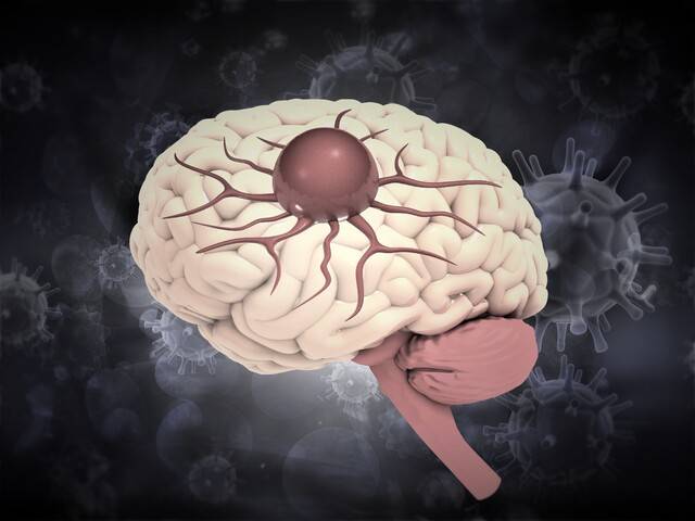 사진은 기사의 특정