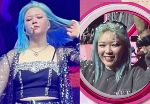 Female entertainers who have gained weight or edema due to the drug side effect are complaining of pain. Above all, it is a pity that it is a problem related to health.Singer and painter Solbi appeared on MBCs Radio Star on the 7th and revealed behind-the-scenes footage that led to edema on his face.I want to give birth to an iPad, but I did not know when to give birth, so I wanted to put it like an insurance, he said. Im constantly freezing eggs.I have been suffering from Hormone Injection because of egg cryosurgery, and it is pouring in the aftermath. However, it was not easy to prepare for pregnancy in a single situation.Also, because of Hormone Injection, my physical strength dropped a lot. Solbi said, I did not like my life because I was swollen and lacked physical strength, but suddenly I felt a diet obsession because of the gaze of others.So I wanted to be recognized as a whole, and I did not want to be ashamed of being fat. I would like to change it to I look more comfortable than when someone else looks a little swollen. Last year, Soyou said, I have sad news, adding, By the time the video goes out, it will be okay, but I have a neck disk.He added, What Im about to say is that Im getting a little fat.Soyous face was more swollen than usual, as Soyou said.Steroids have excellent effects on inflammation relief, but there are side effects such as edema, palpitations, and increased appetite.Jeongyeon, a member of the girl group TWICE, has been out of action four times due to her health problems, as she has suffered from psychological anxiety disorders and neck disorders since 2020.Since then, he has been back in front of his fans with a unique professional consciousness. Although he refrained from dancing as if his neck was not healed at the time, it was an opportunity to feel his love (TWICE fan club name).In recent years, I have been cheering in front of my fans with a slim figure that I do not know.Singer Lee Eun-ha also increased his weight to 94kg with the steroid side effect.I had a steroid injection every two days to forget the pain, and I had Cushings syndrome with the injection side effect, he said.Lee Eun-ha gained 35 kilograms with the  ⁇ Side Effect and weighed up to 94 kilograms.Fans and the public should give stars who suffer from health problems enough time to recover in peace. Blaming self-care for weight gain due to health problems for no other reason is just violence under the guise of attention.Maybe it is true support to love them themselves.