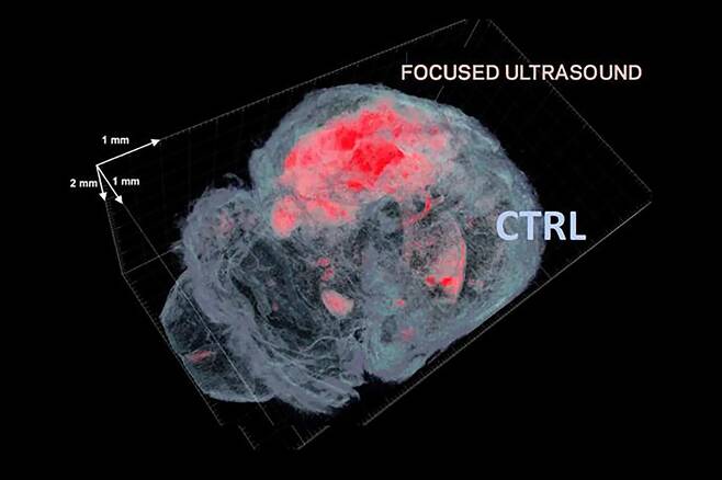 쥐의 뇌에 초음파를 집중시켜 (붉은색) BBB 투과성을 높이는 모습. 사진=Ultrasound and Elasticity Imaging Laboratory/Columbia Engineering